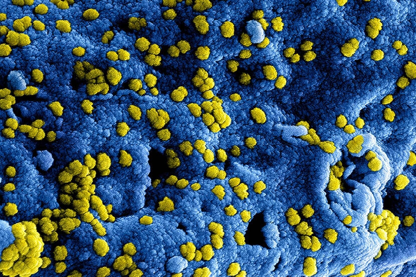 Onze aanpak rondom het Coronavirus